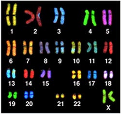 Human Karyotype female