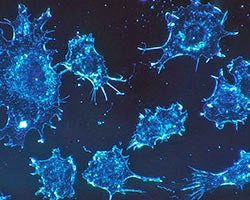 Cancer cells