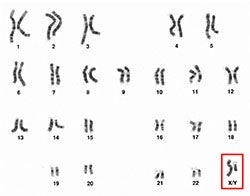 Human male karyotype