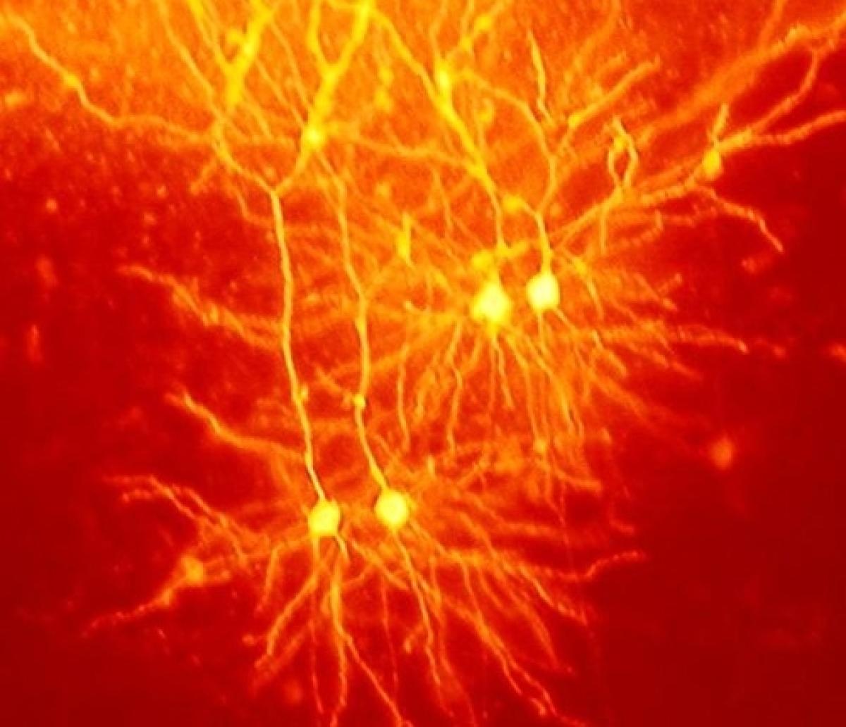 neurons pictures in red and yellow