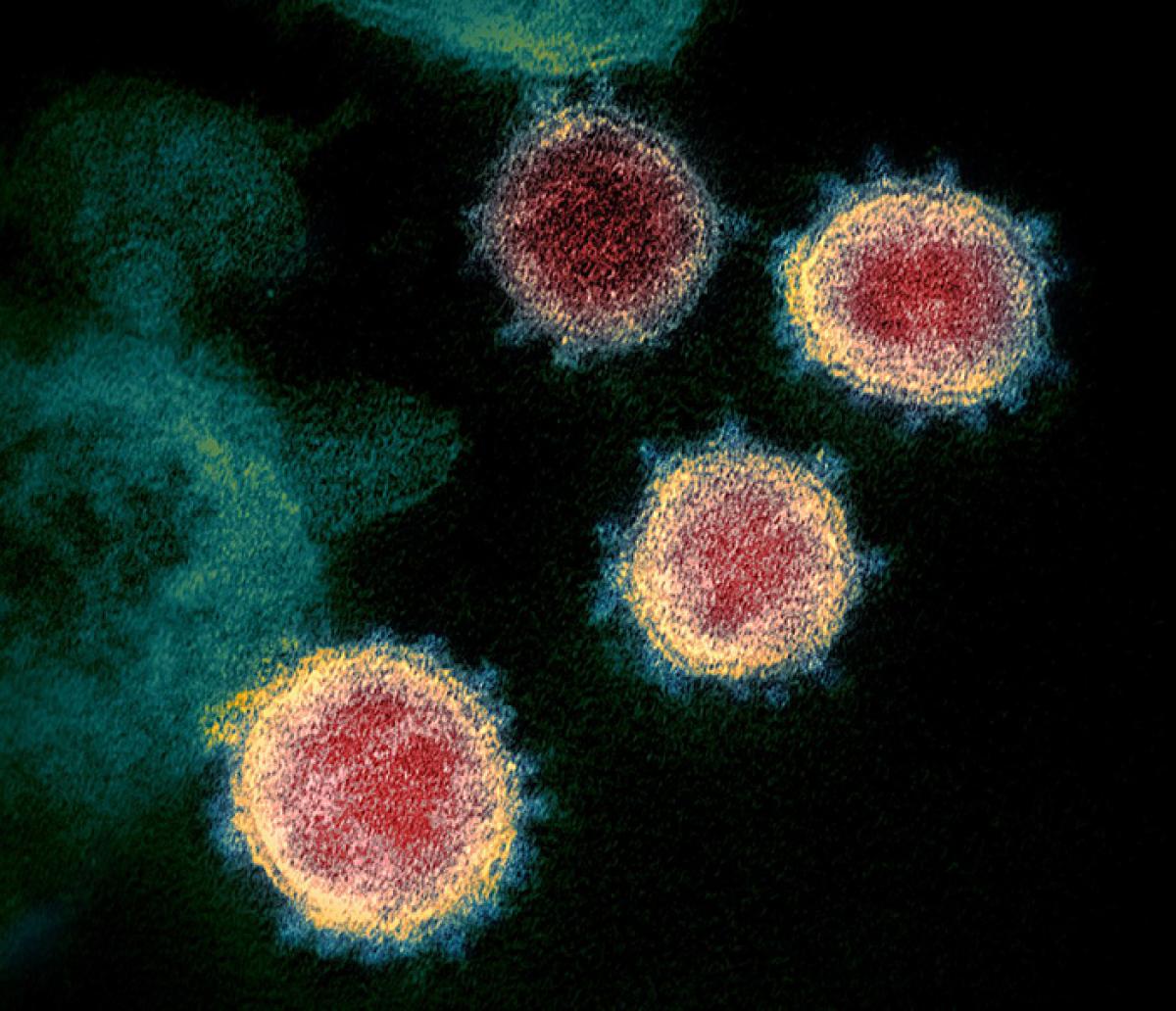 The coronavirus that causes COVID-19